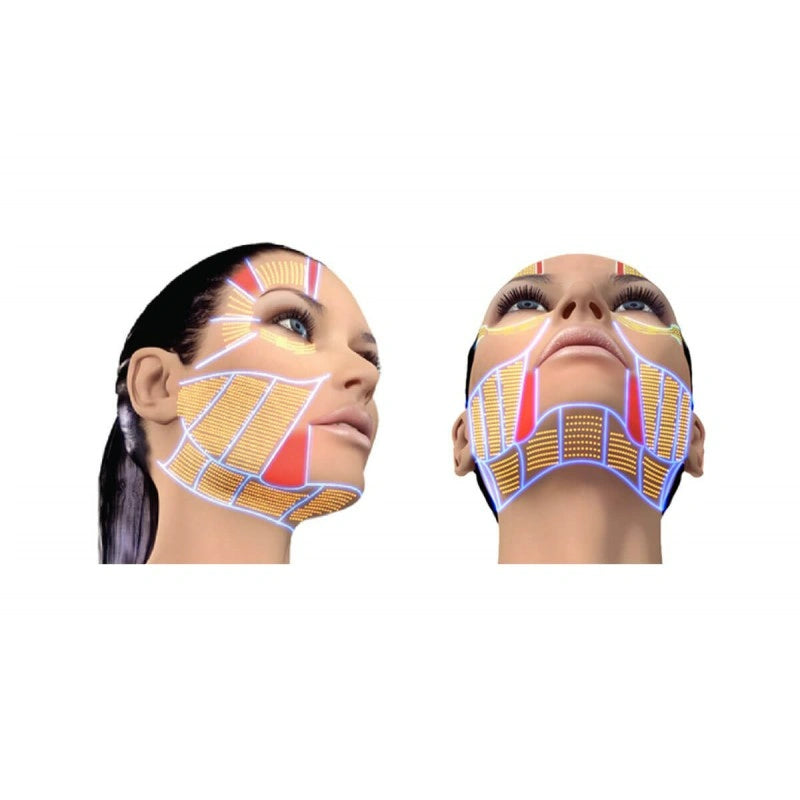 Maquina SMAS HIFU Super-Lift mini 2