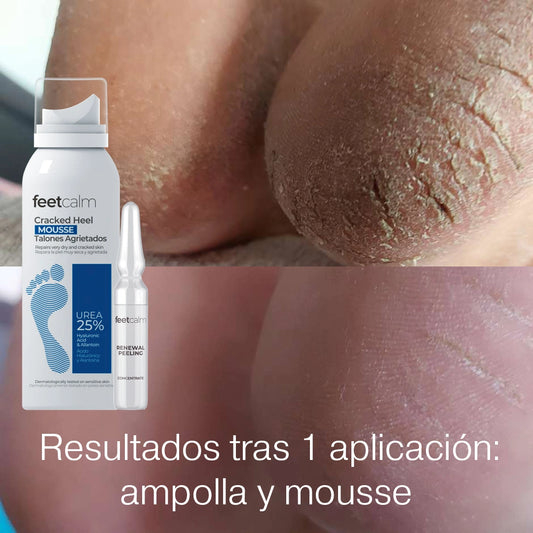 Resultados tras 1 aplicación feetcalm