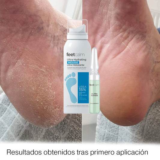 Ultra moisturizing mousse 15% urea